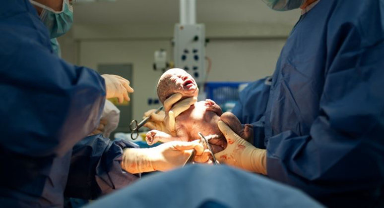 Los partos mediante cesárea han aumentado en Cantabria hasta alcanzar el 25%