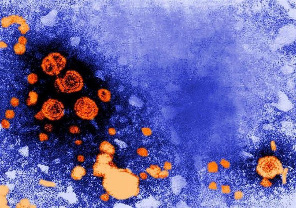 La hepatitis viral causa tantas muertes como la malaria o el VIH- SIDA
