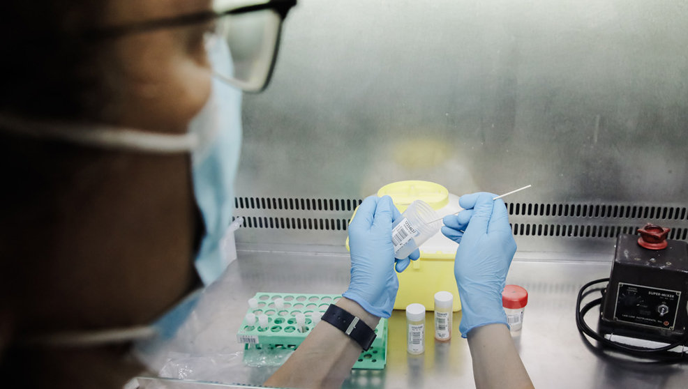 Una técnico de laboratorio sostiene una de las pruebas de análisis para la viruela del mono, en el Hospital Ramón y Cajal, a 30 de mayo de 2022, en Madrid (España)