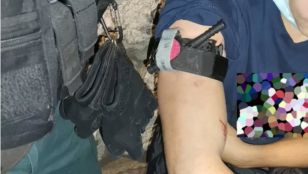 La Guardia Civil auxilia a un joven herido grave en Noja | Foto: Guardia Civil